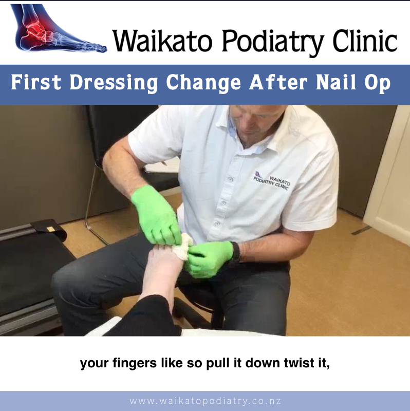 first dressing change after nail surgery