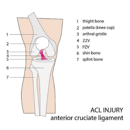 acl diageram