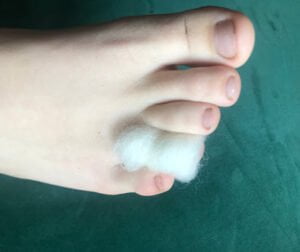 Hikers wool for blister prevention