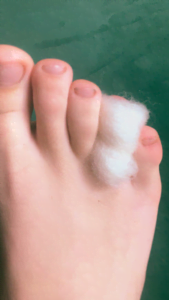 Hikers wool preventing between the toe blisters